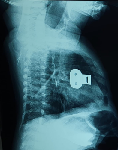 Une image contenant film radiographique, Imagerie médicale, radiologie, radiographie Description générée automatiquement