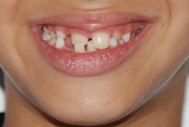 Une ima</p>
                            						</div>
													<div class=